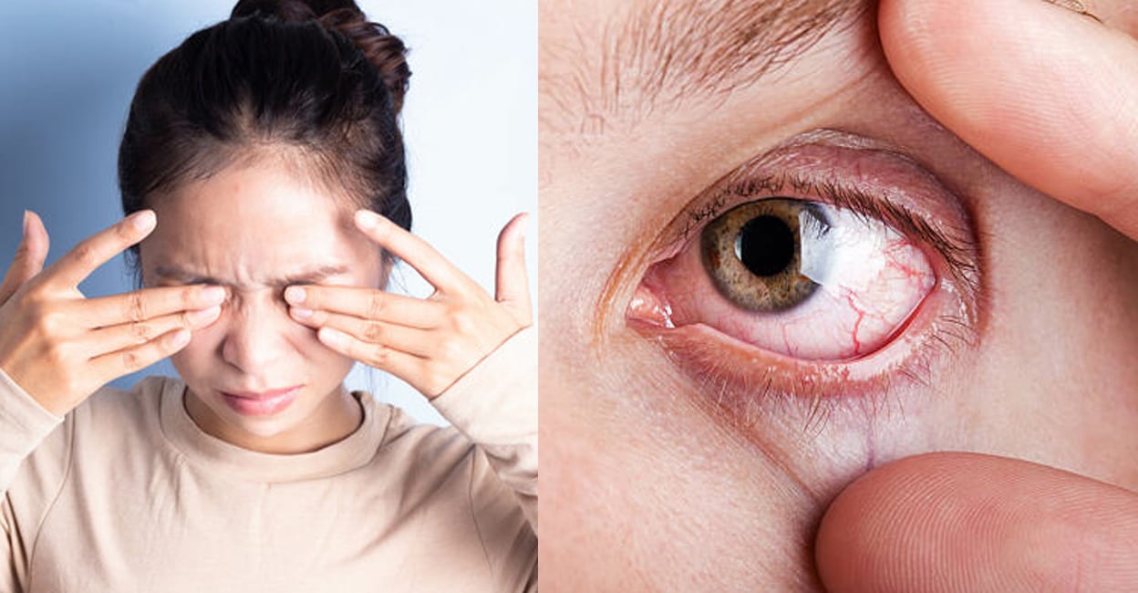 10-common-eye-diseases