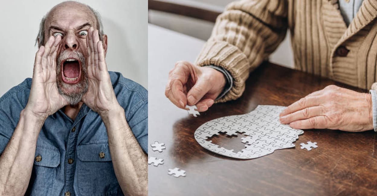 Dementia-symptoms-and-treatments