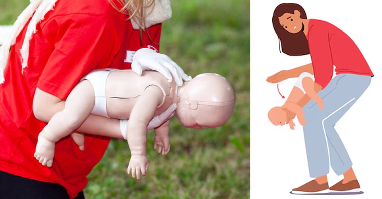 Heimlich-Maneuver-procedure