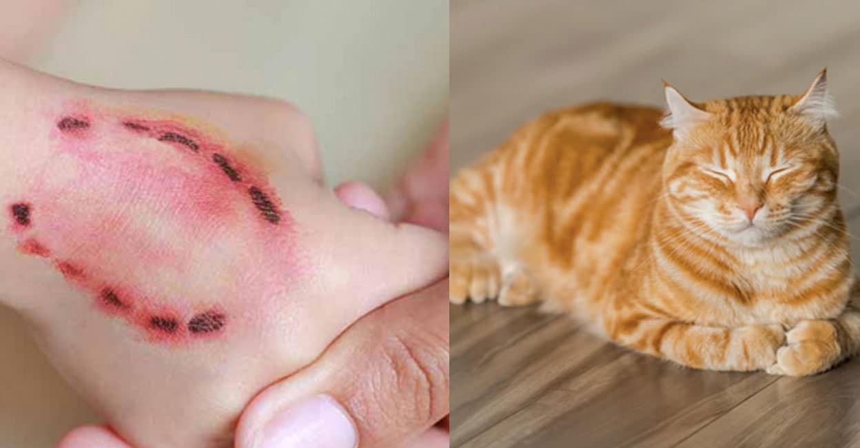 cat-bite-