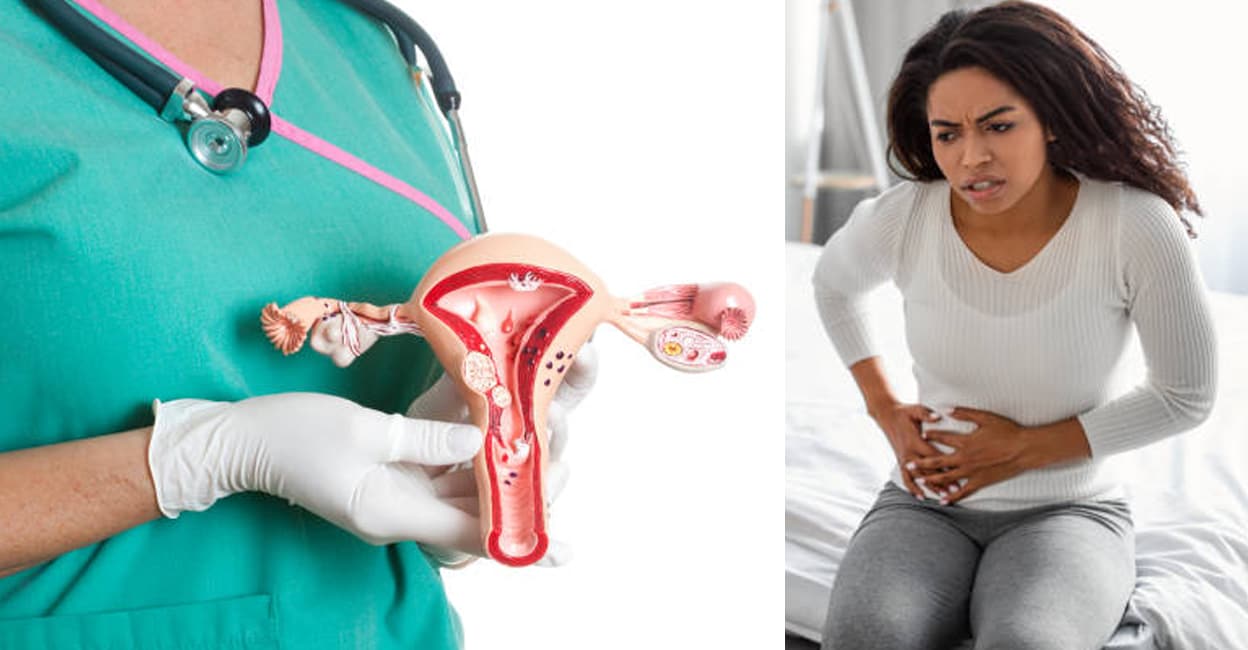 uterus-cyst
