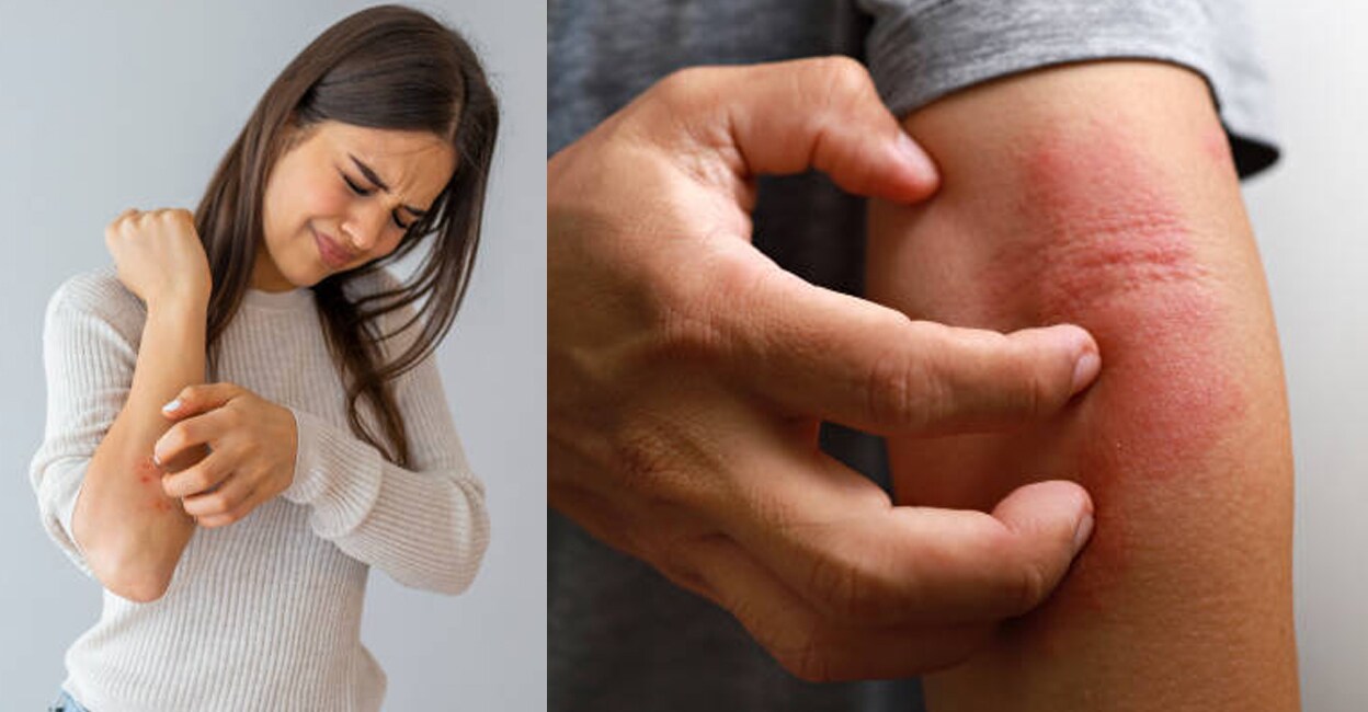 skin-diseases-internal-issues