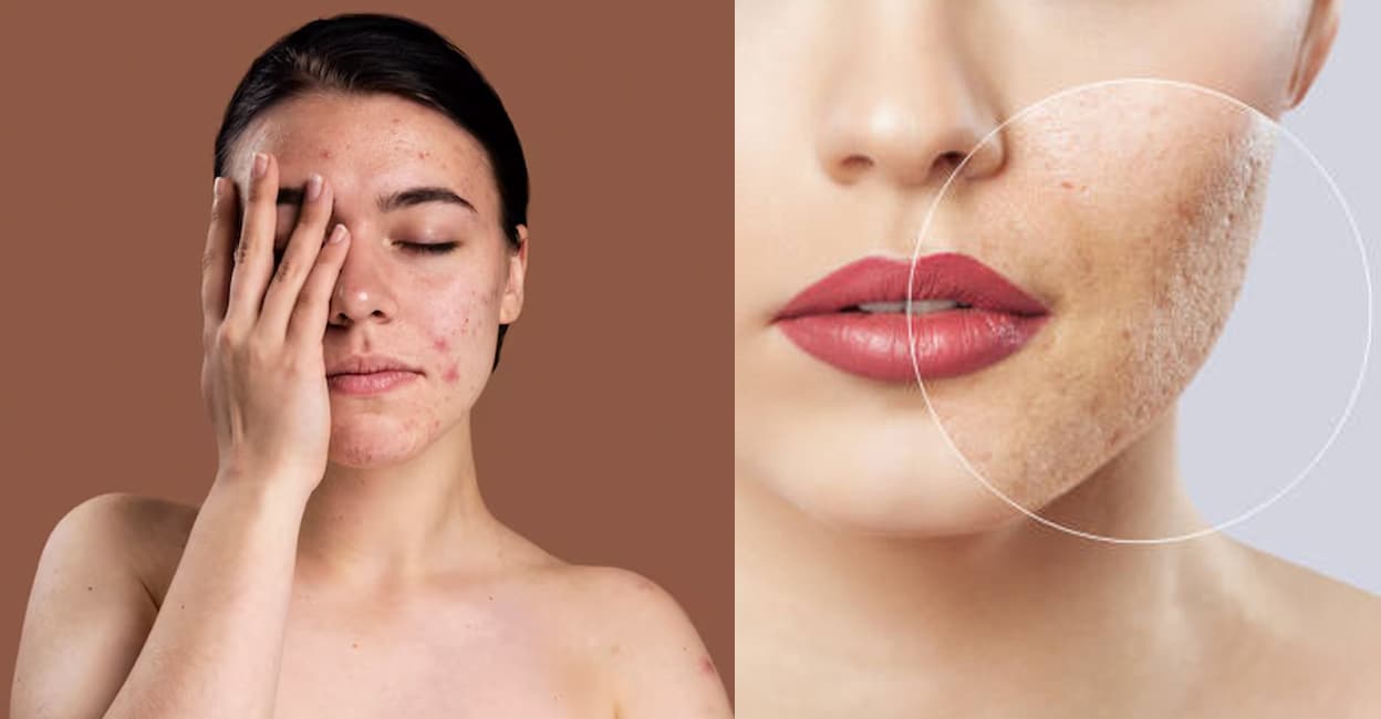 face-marks-cover