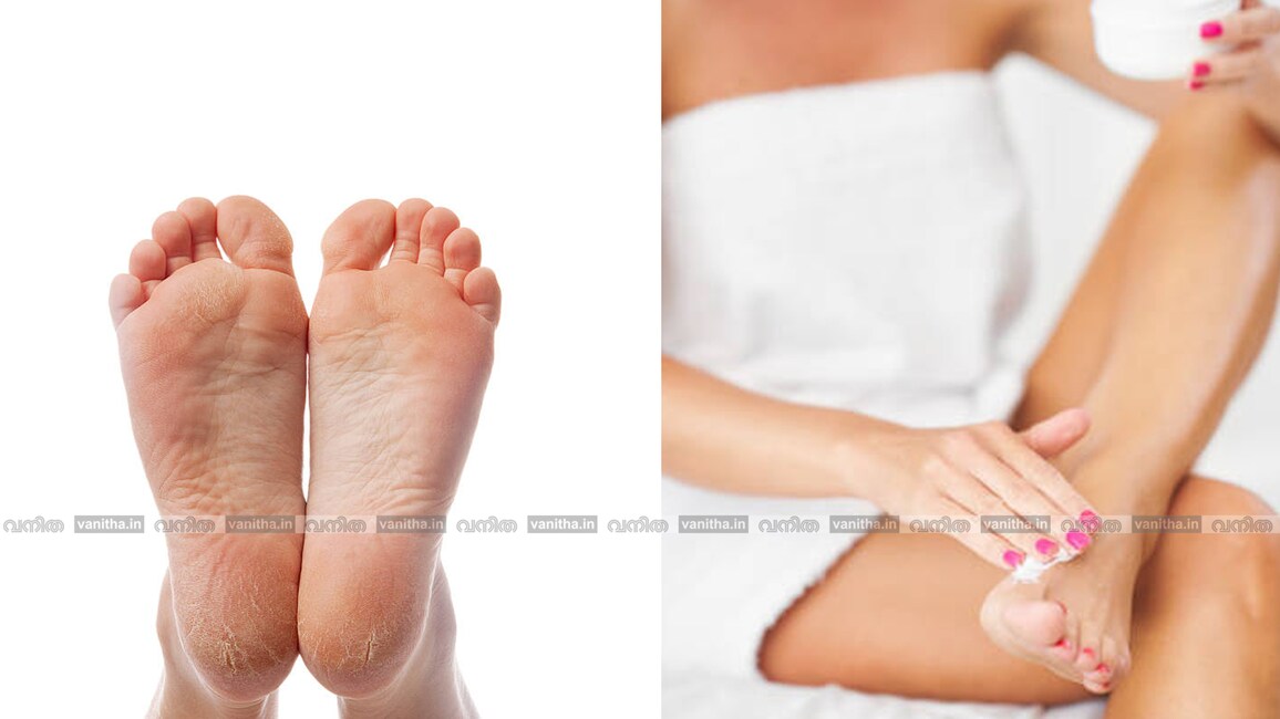 feetcare