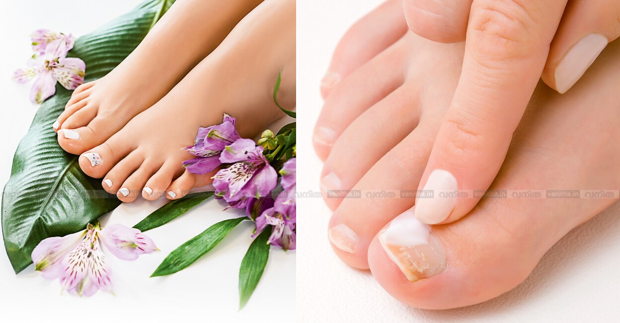 foot-care-beauty-tips