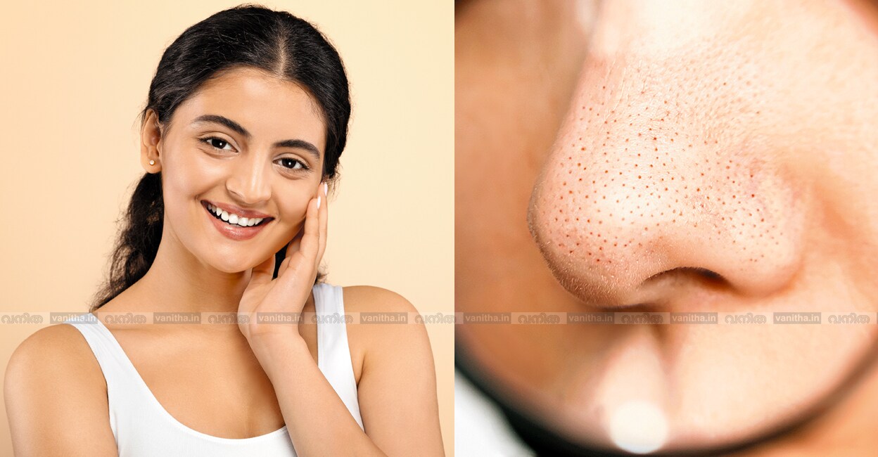 blackheads-whiteheads-skin-care