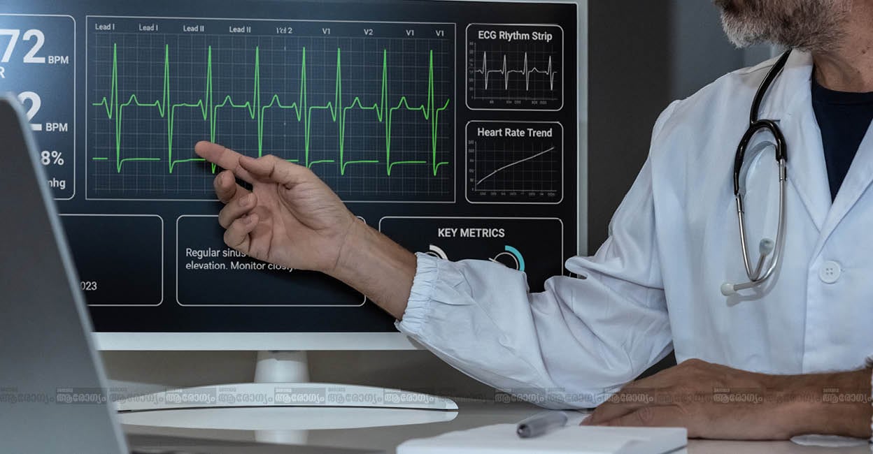 ecg-facts