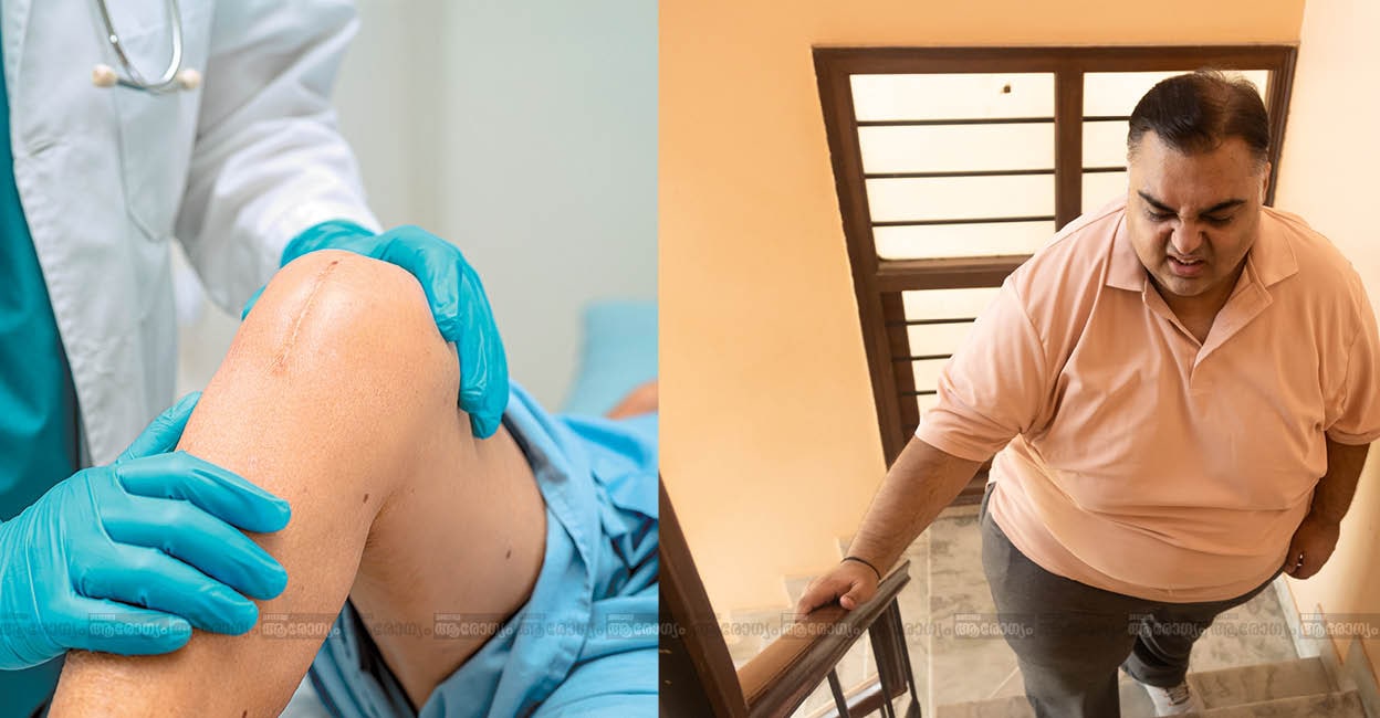 kneereplacement44 kneereplacement44