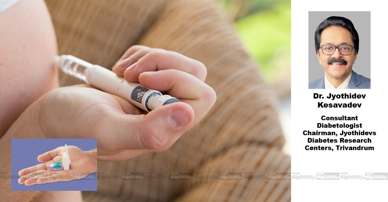 ഇൻസുലിൻ കുത്തിവയ്പ്. ഇൻസെറ്റിൽ ഇൻഹേലർ രൂപത്തിലുള്ള ഇൻസുലിൻ  