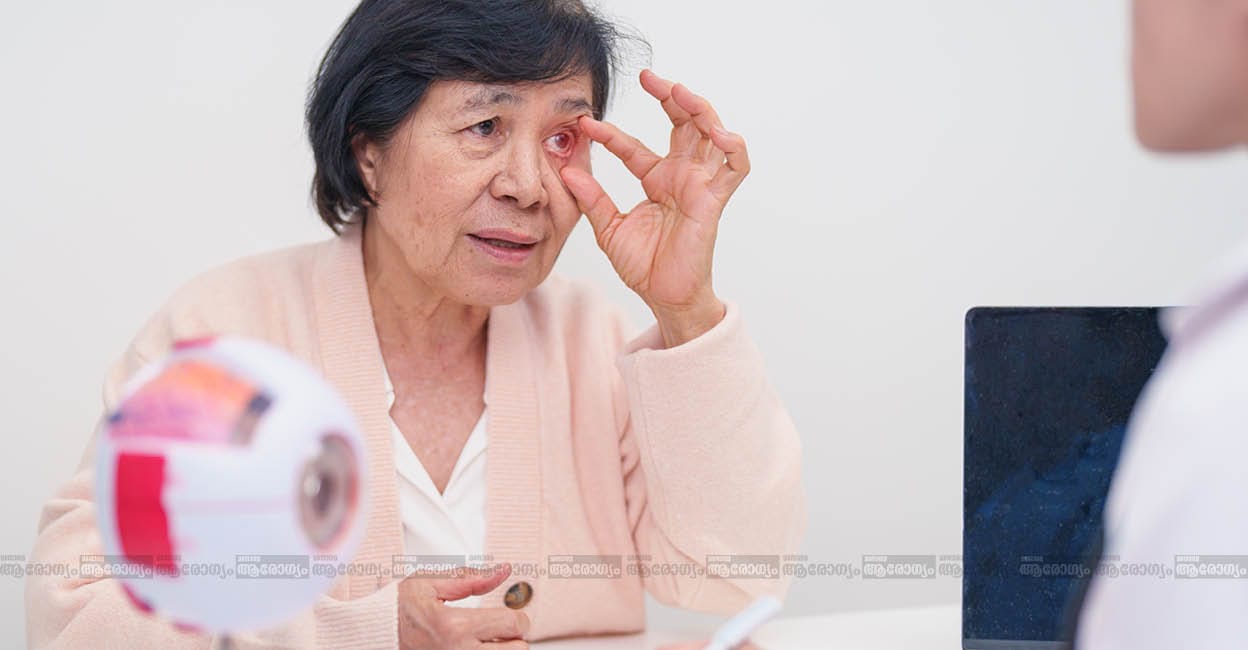 glaucoma-eye