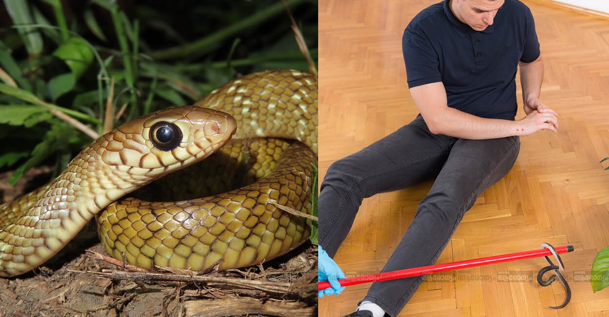 snakebite