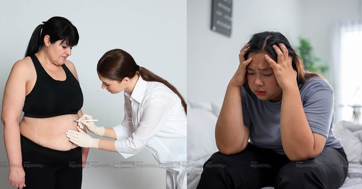 obesity-surgery