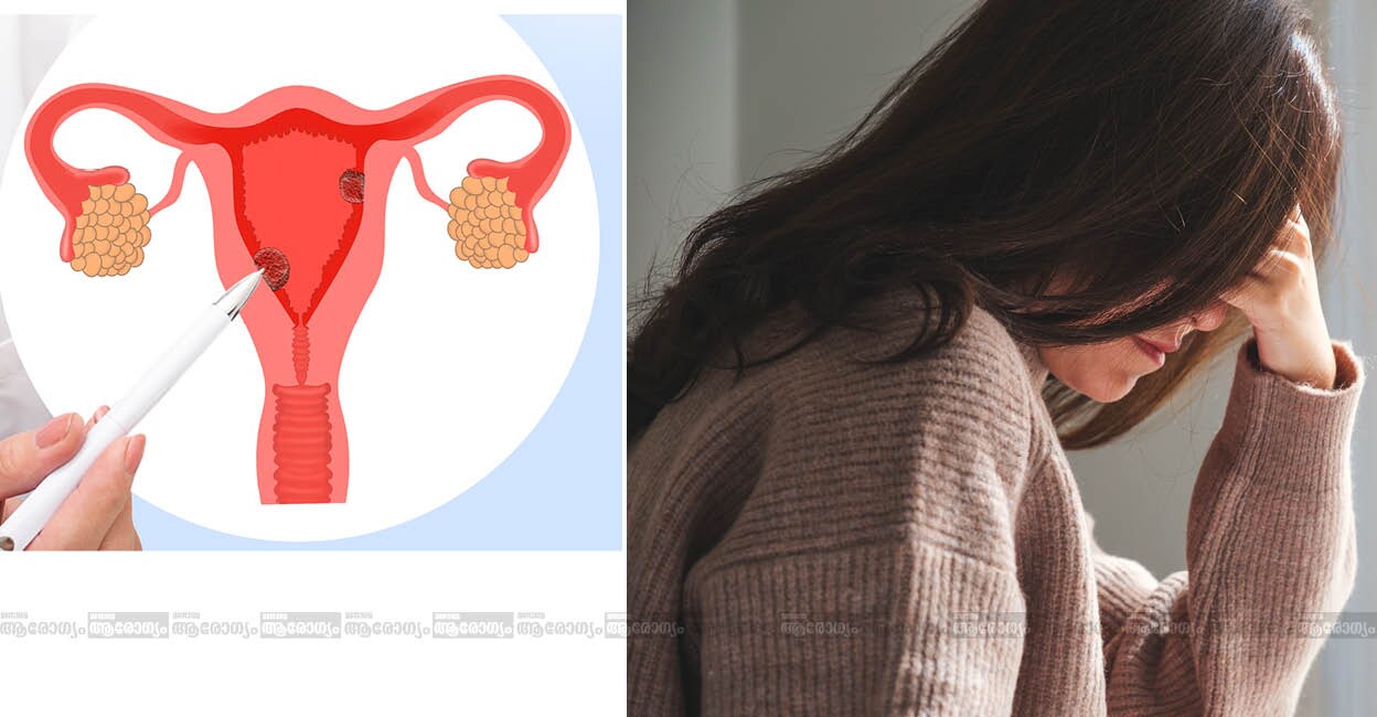 uterusremoval