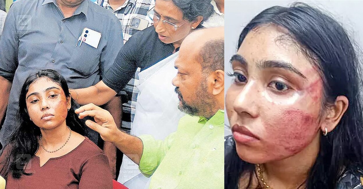 syamili-attacked