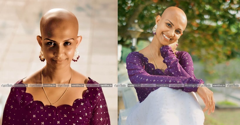 തലമുടിക്കു പുറമേ പുരികവും കൺപീലികളും പൊഴിഞ്ഞു; തലയിൽ മരുന്നിട്ടാലോ, പിന്നാലെ വരുന്ന പുകച്ചിൽ ജീവനെടുക്കും: അലോപേഷ്യ ടോട്ടാലിസിലൂടെ കടന്നു പോകുന്ന അശ്വതി പറയുന്നു