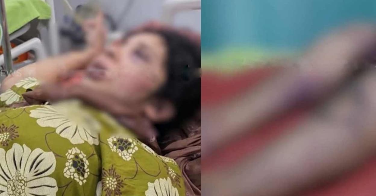 boy-friend-attacked-kozhikode