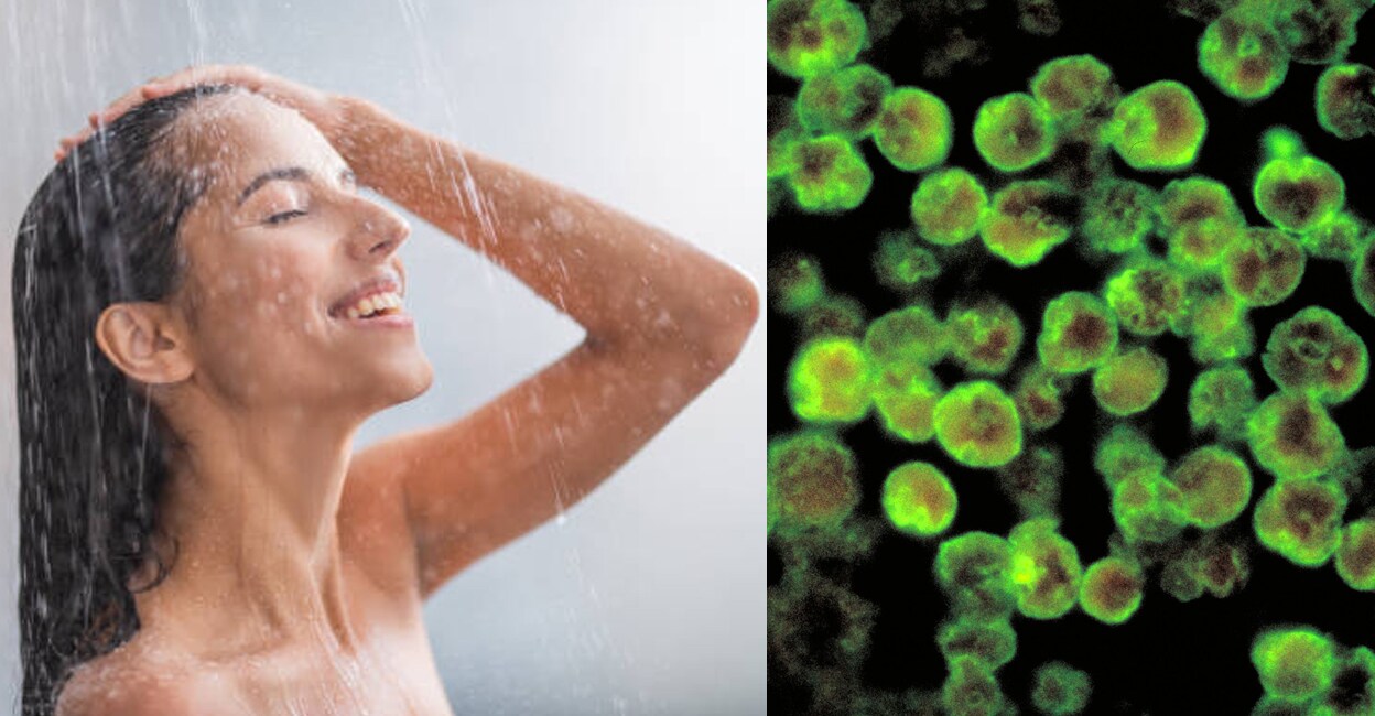 Rising-Amoebic-Meningoencephalitis