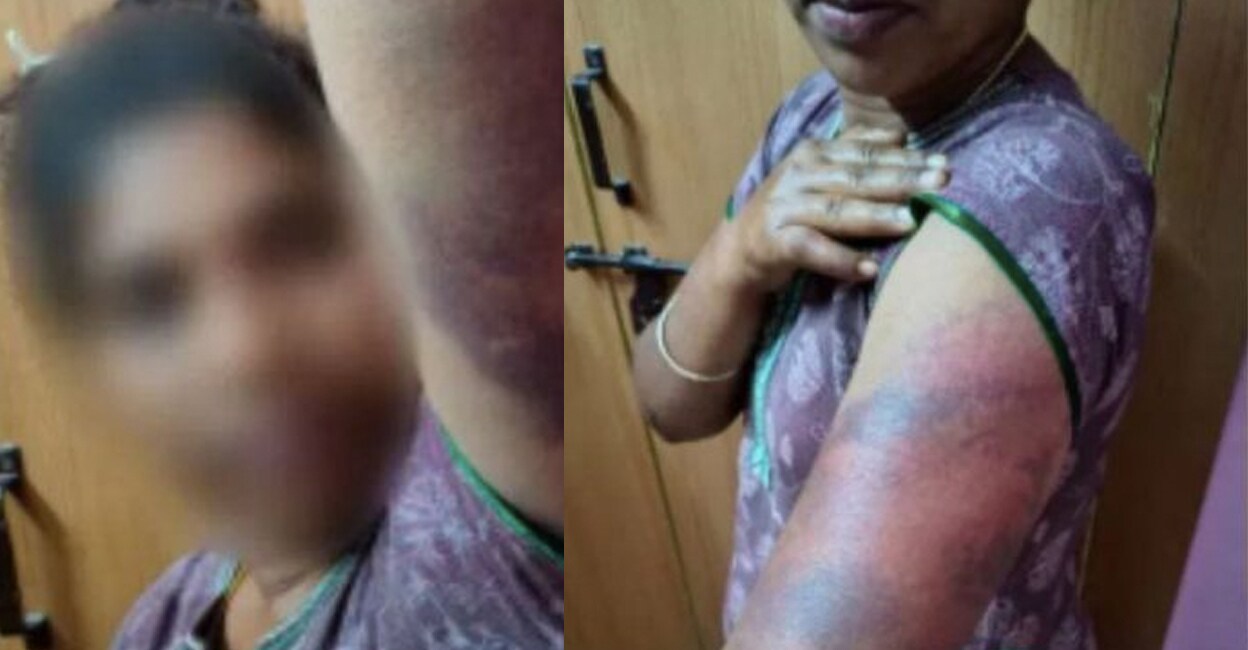 woman-domestic-violence-thimmappa