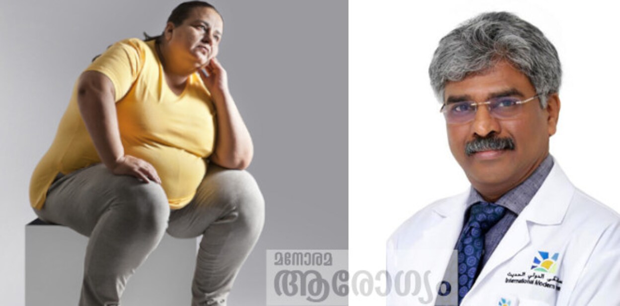 obesity576
