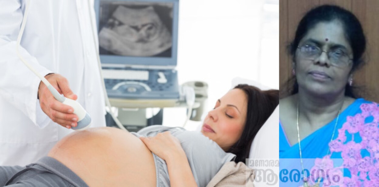 preg4456