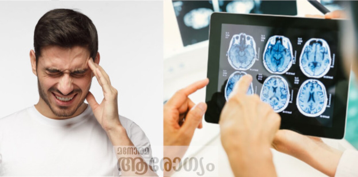 brain134546