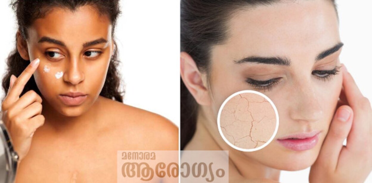 dryskin535