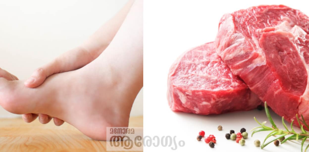 gout324