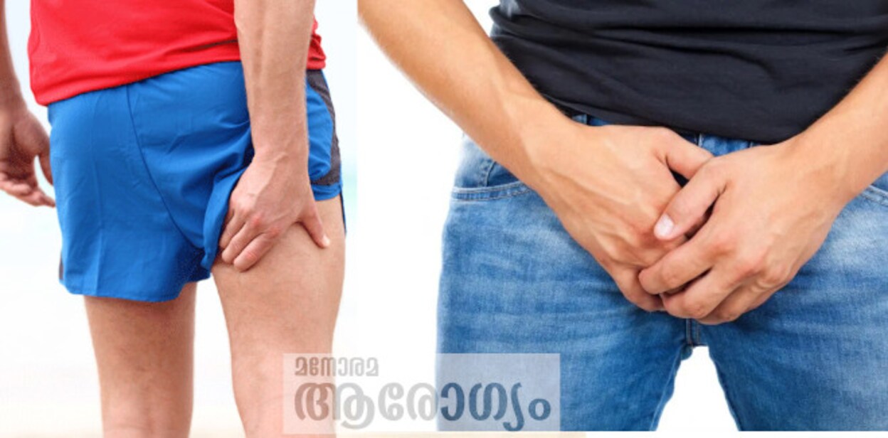infmale232