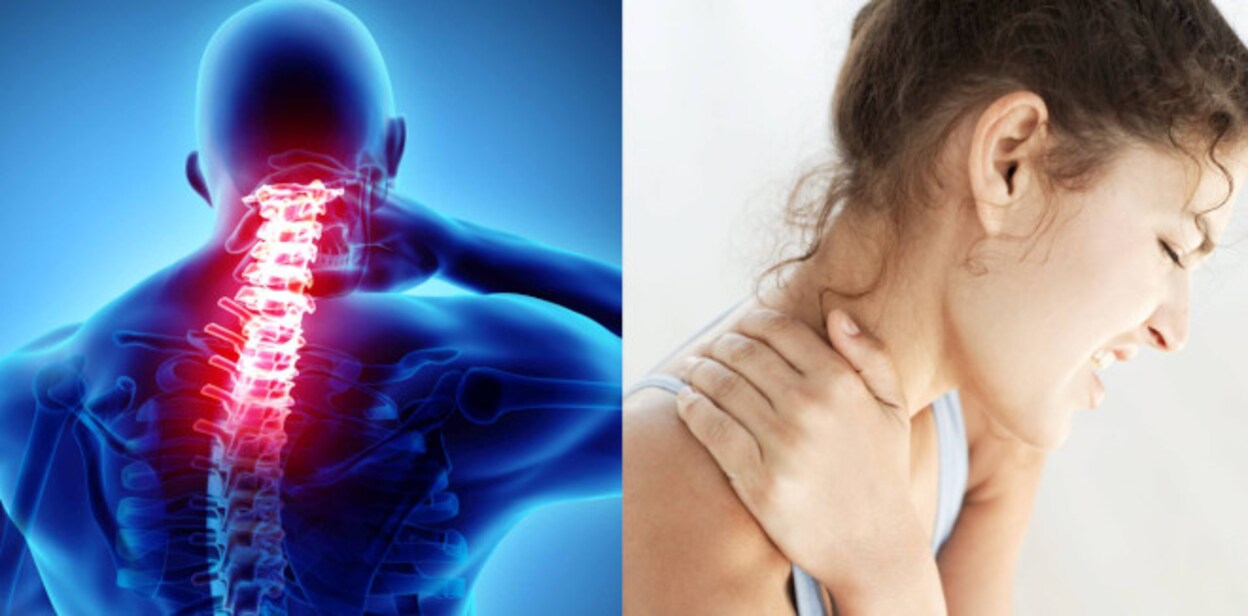 neckpain556
