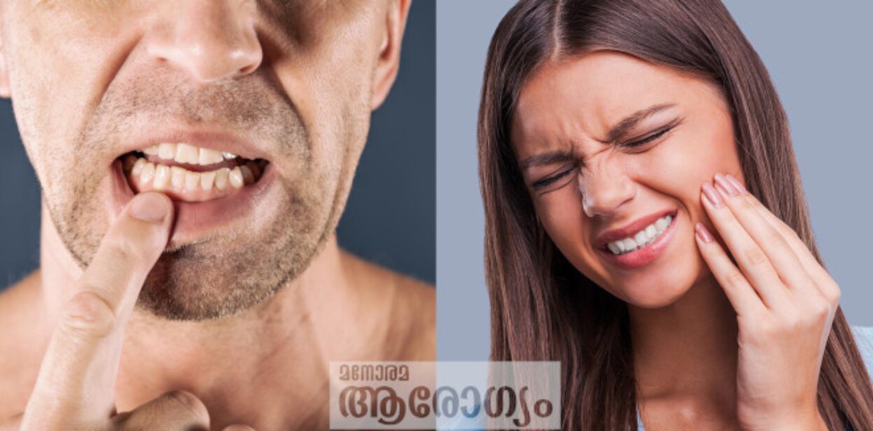 teethpain435