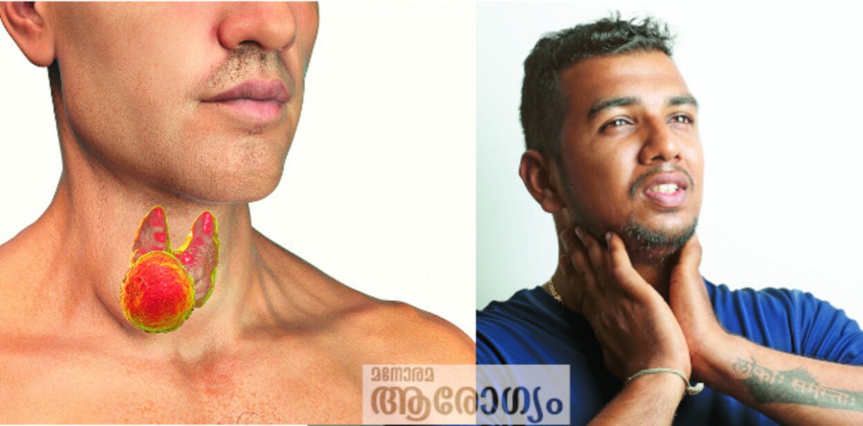 thyroidw3r3