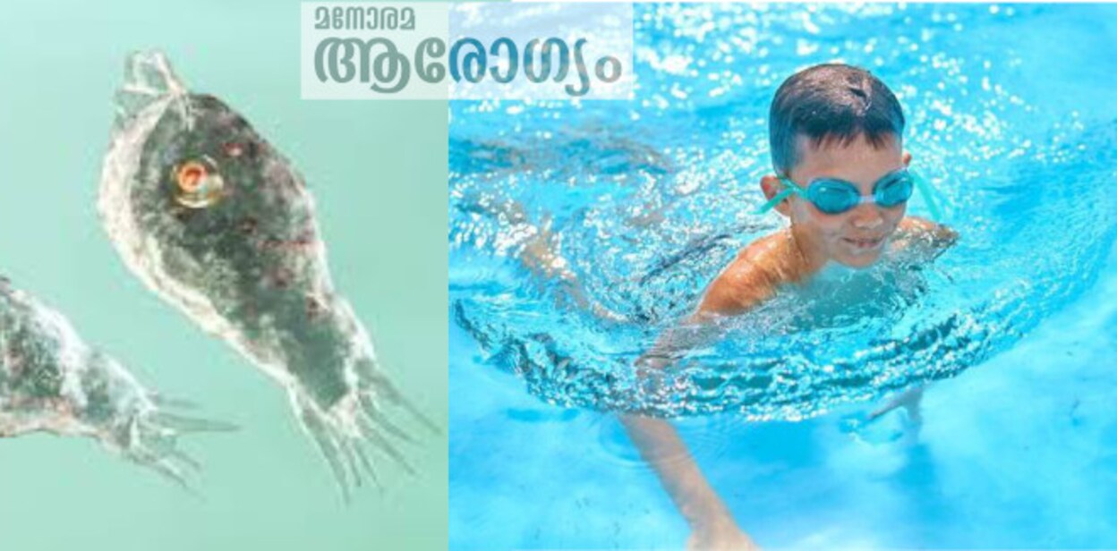 amoebainf3243