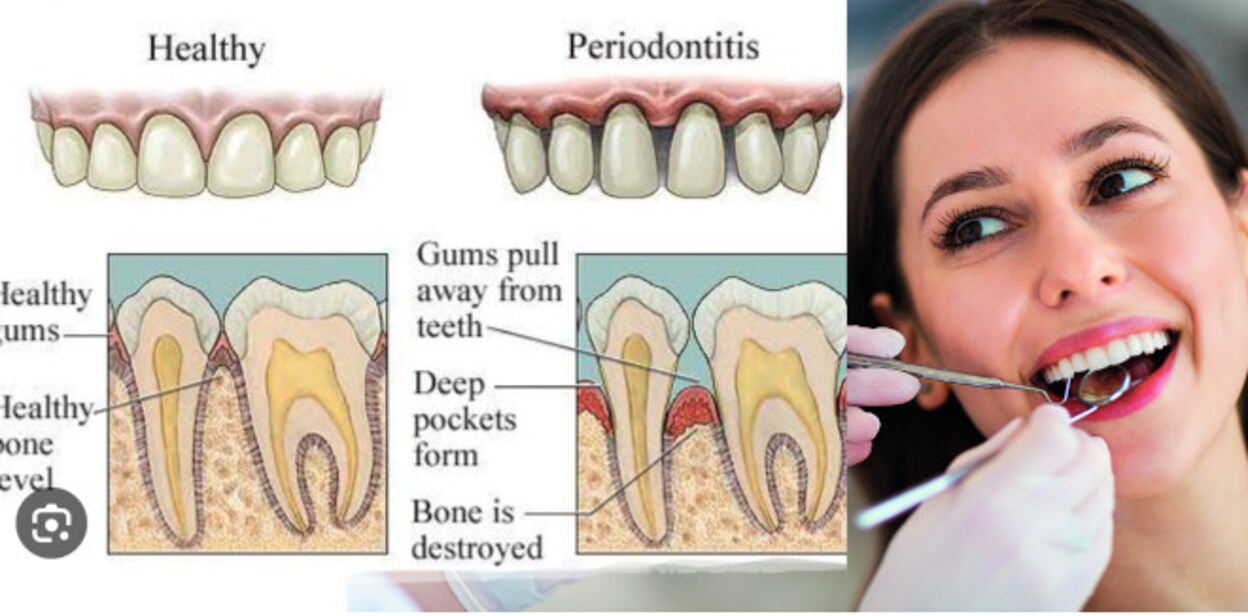 dent32432