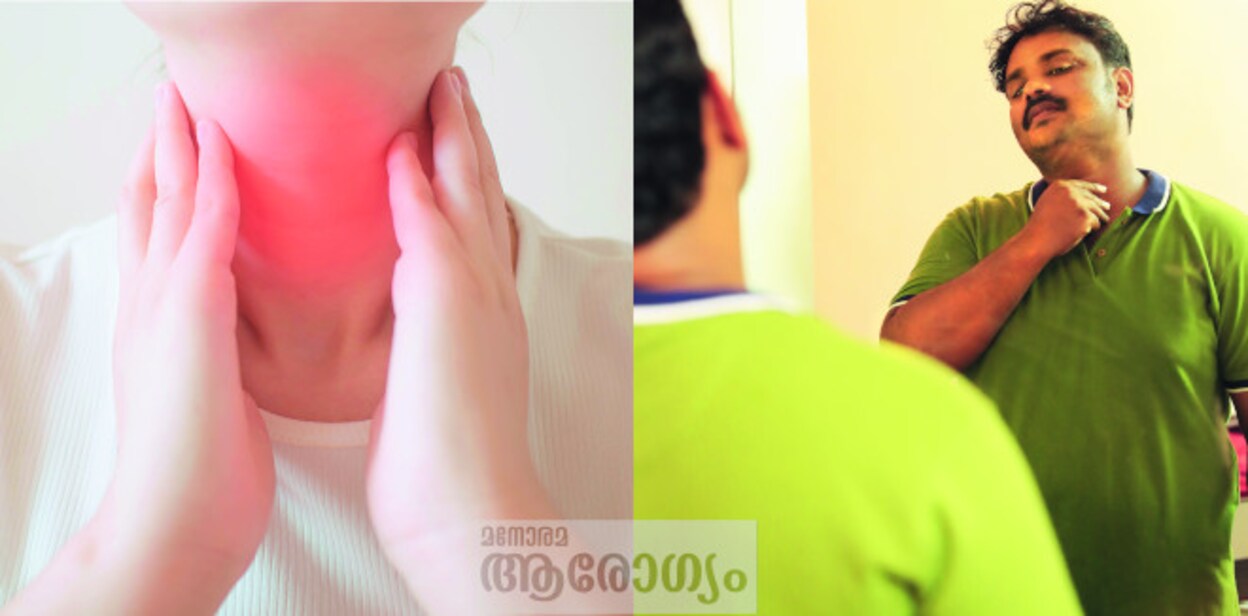 thyro54654