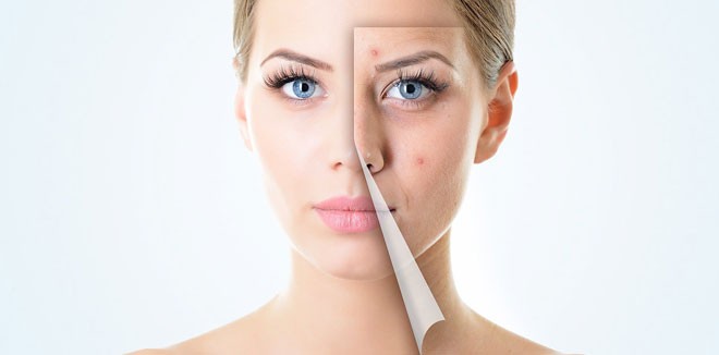 skin-care-pimples